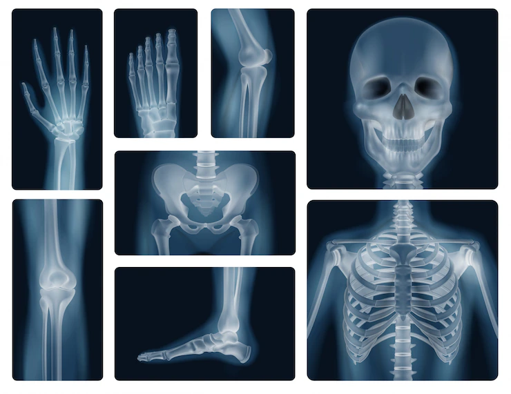 Professional X-ray imaging and diagnostics at Neibosco Healthcare in Lekki, Lagos